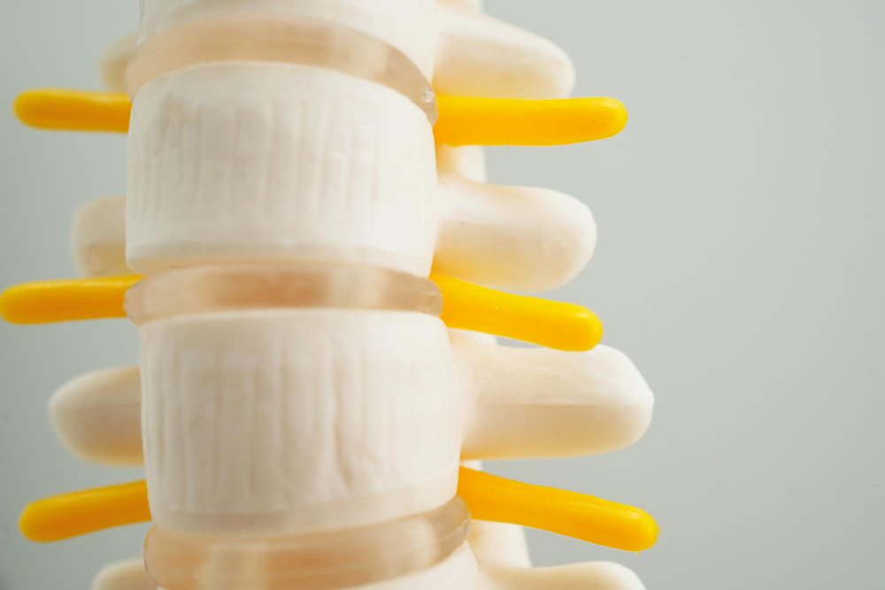 Degenerative Disc Disease Treated in Ohio